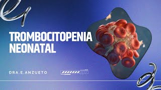 TROMBOCITOPENIA NEONATAL Dr E Anzueto [upl. by Chaffin]