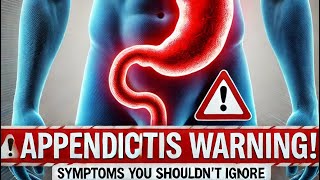 “Appendicitis Warning Signs Don’t Miss These Symptoms” [upl. by Irby844]