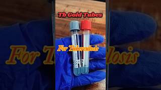 Tb Gold TubesTb Gold sample collection tubesTuberculosis test youtubeshorts shorts tranding [upl. by Suoiluj263]