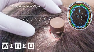 The Science Behind Elon Musk’s Neuralink Brain Chip  WIRED [upl. by Bendite]