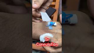 Iv cannulation  cannula doctor baby ivcannulation SMpharmacy subscribe [upl. by Dyolf275]