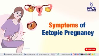 Symptom of Ectopic Pregnancy  EctopicPregnancy [upl. by Niamert640]