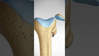 What happens when you dislocate your Knee Cap MPFL Tears and Reconstruction kneeanatomy [upl. by Selby989]