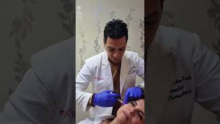 Profhilo 5 injection points 💉 Amazing quick amp effective بروفايلو ٥ نقاط للحقن  روعة و سريع [upl. by Rod]