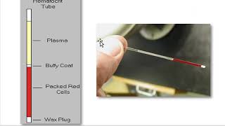 How to Measure the Hematocrit  physio lab practical [upl. by Ekaj42]