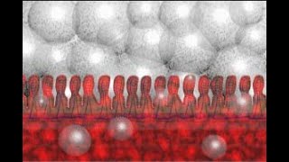 Necrotizing Enterocolitis NEC Part 2 Animation by Cal Shipley MD [upl. by Udenihc235]