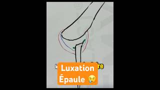 Luxation épaule shoulderinjury anatomy [upl. by Ameehsat]