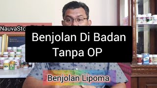 Benjolan Lemak Di Bagian Badan Lengan Lipoma Tanpa OP [upl. by Cedar]