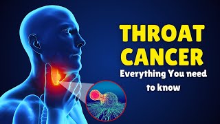 Throat Cancer – Causes Signs and Symptoms Diagnosis amp Treatment [upl. by Cliff]