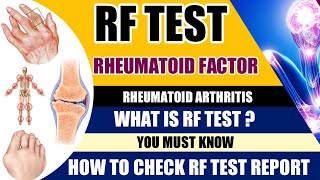 Rheumatoid Factor Test  What is RA factor test  Rheumatoid Arthritis [upl. by Vergil37]