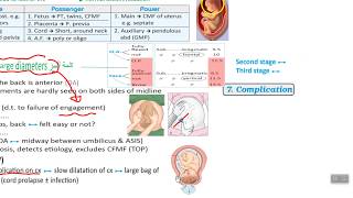 Malpresentations scheme [upl. by Zaid531]