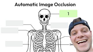 How to Do Automatic AI Image Occlusion in Wisdolia  Export to Anki [upl. by Morty631]