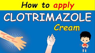 Clotrimazole cream Lotrimin How to apply  Uses and Side effects [upl. by Madonna]