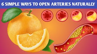 Best Ways To Open Arteries Naturally  Artery Blockage Removal Naturally  healthgems [upl. by Belac]