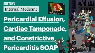 Pericardial Effusion Cardiac Tamponade amp Constrictive Pericarditis Part 1 Internal Medicine [upl. by Ange]