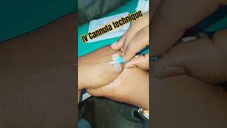 IV Cannula technique  How injections are given IV injection kaise lagate hain short medical reels [upl. by Marcelle256]