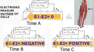 Electromyography EMG Biopac lecture [upl. by Glennon362]