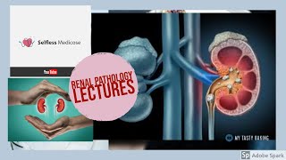 RENAL PATHOLOGY lecture 19 CHRONIC KIDNEY DISEASE  must watch to grab it [upl. by Harragan]