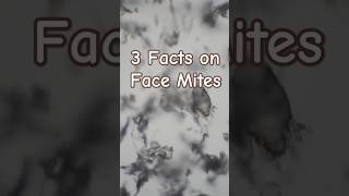 Dont Panic 3 Facts on Face mites [upl. by Perren]