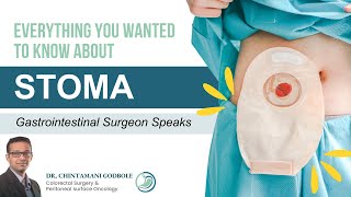 What is Stoma How to Take Care of Stoma Bag I Temporary amp Permanent Stoma I Dr Chintamani Godbole [upl. by Mis108]