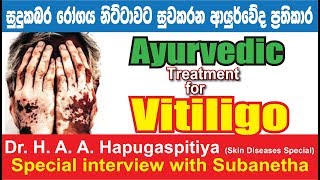 Vitiligo quot Sudu kabara quot Ayurvedic treatment sri lanka Dr HAA Hapugaspitiya [upl. by Remmos]