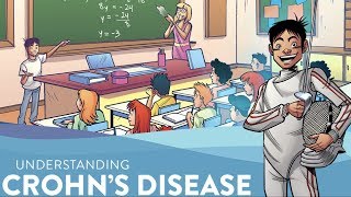 Understanding Crohns Disease  Jumo Health [upl. by Odraleba956]