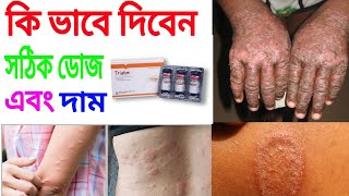 trialon ইনজেকশন এর কাজ কি full review Bangla [upl. by Berk]