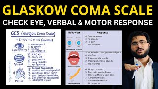 Mastering the Glasgow Coma Scale Complete Guide Scoring System and Clinical Applications [upl. by Pazit]