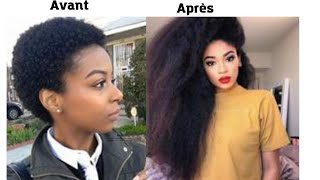 comment faire pousser tes cheveux 10 fois plus vite en une semaine [upl. by Sachsse]