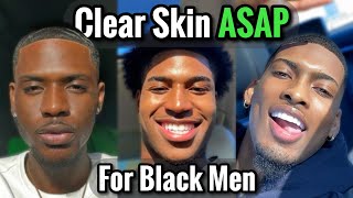 How to Get Clear Skin ASAP for Black Men [upl. by Gunnar]