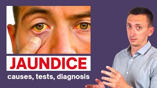 A Clinical Approach to Jaundice [upl. by Malka]