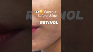 RetinolThe Ugly Truth you must know shorts retinol skincare retinal fyp beginnerfriendly [upl. by Hillegass]