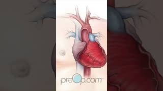 Cardiac Catheterization [upl. by Haral]