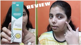 NOMARKS Ayurvedic Antimarks Cream Review  For Oily Skin  Good Product [upl. by Lyda]