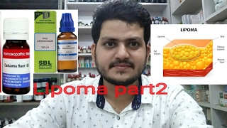 lipomaHomeopathic medicine for lipoma part 2 [upl. by Suitangi172]