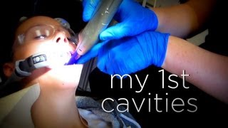 MY FIRST CAVITIES [upl. by Shaia]