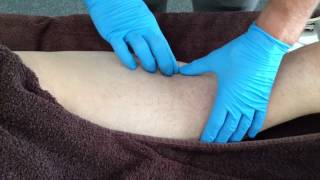 Dry Needling Biceps Femoris [upl. by Ardussi]