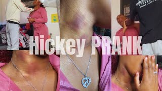 Hickey Prank On My Protective boyfriend got heated [upl. by Celestyna]