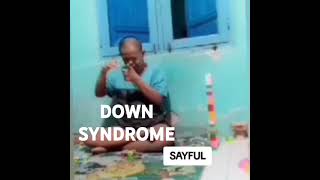 DOWN SYNDROME [upl. by Aivle]