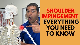 Shoulder Impingement Everything You Need To Know To Get Healthy Again [upl. by Anitsyrhk]