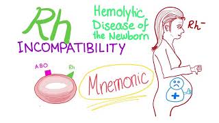 Rh incompatibility mnemonic [upl. by Mulligan]