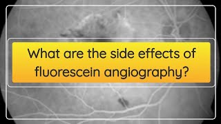 What are the side effects of fluorescein angiography [upl. by Zeni]