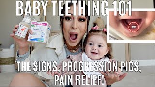 Baby TEETHING The SURE SIGNS PROGRESSION PICS Teethers amp Remedies [upl. by Ainaznat]