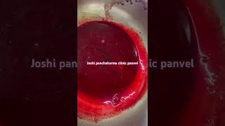 ayurveda vitiated blood Emesis of blood post hirudotherapy Rakthdosh Rakthduddhi Detox Blood [upl. by Nylanna]