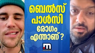 മിഥുന് ബാ​ധിച്ച ബെൽസ് പാൾസി രോ​ഗമെന്താണ് മിഥുന് എന്ന് തിരികെ വേദികളിലെത്താനാകും   Mithun Ramesh [upl. by Nilkcaj996]