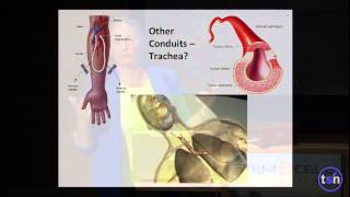 Keynote Off the Shelf Engineered Arteries [upl. by Anerbes]