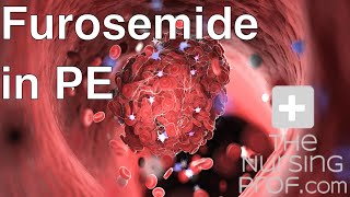 Furosemide in Pulmonary Embolism [upl. by Aivan]