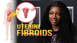 Uterine Fibroids Complications  MarieCatherine Kodjo [upl. by Oirogerg849]