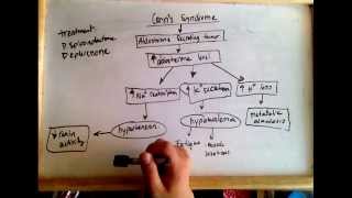 Conns syndrome hyperaldosteronism  cause and treatment [upl. by Anirba576]