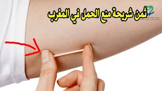 ثمن شريحة منع الحمل في المغرب IMPLANON prix maroc [upl. by Jamey771]